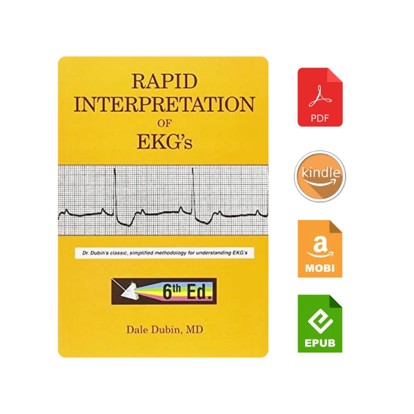 Rapid Interpretation Of Ekg's, Sixth Edition